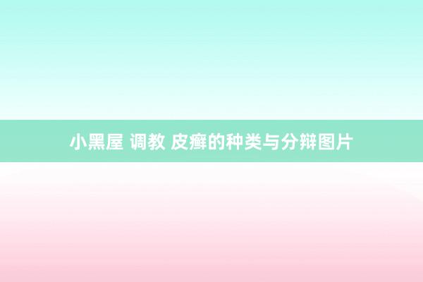 小黑屋 调教 皮癣的种类与分辩图片